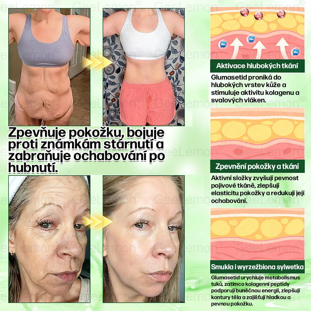 oficiální obchod | 👩‍⚕️ 👩‍⚕️𝐆𝐞𝑒𝐥𝑒𝐦𝐨𝐧® Glum𝐚𝐬𝐞tide 8 v 1 – Zeštíhlující nano mikrojihlový náplast – Pouze jednou denně ✅ Viditelné změny již za 7 dní na obezitu, ochablou pokožku a zdraví