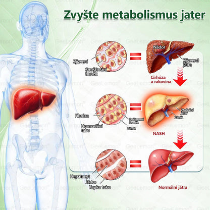 oficiální obchod | 👩‍⚕️ 👩‍⚕️𝐆𝐞𝑒𝐥𝑒𝐦𝐨𝐧® Glum𝐚𝐬𝐞tide 8 v 1 – Zeštíhlující nano mikrojihlový náplast – Pouze jednou denně ✅ Viditelné změny již za 7 dní na obezitu, ochablou pokožku a zdraví