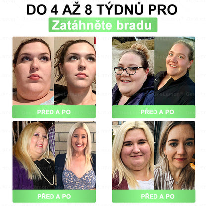 oficiální obchod | 👩‍⚕️ 👩‍⚕️𝐆𝐞𝑒𝐥𝑒𝐦𝐨𝐧® Glum𝐚𝐬𝐞tide 8 v 1 – Zeštíhlující nano mikrojihlový náplast – Pouze jednou denně ✅ Viditelné změny již za 7 dní na obezitu, ochablou pokožku a zdraví