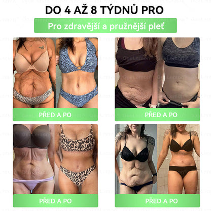 oficiální obchod | 👩‍⚕️ 👩‍⚕️𝐆𝐞𝑒𝐥𝑒𝐦𝐨𝐧® Glum𝐚𝐬𝐞tide 8 v 1 – Zeštíhlující nano mikrojihlový náplast – Pouze jednou denně ✅ Viditelné změny již za 7 dní na obezitu, ochablou pokožku a zdraví