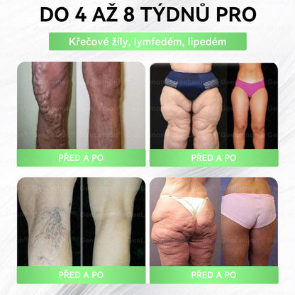 oficiální obchod | 👩‍⚕️ 👩‍⚕️𝐆𝐞𝑒𝐥𝑒𝐦𝐨𝐧® Glum𝐚𝐬𝐞tide 8 v 1 – Zeštíhlující nano mikrojihlový náplast – Pouze jednou denně ✅ Viditelné změny již za 7 dní na obezitu, ochablou pokožku a zdraví